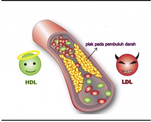 kolesterol hdl 300x242